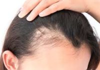 Hair Loss